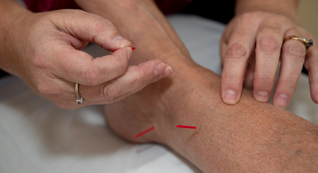 Acupuncture therapy at Spaulding Outpatient Center South Shore YMCA Quincy