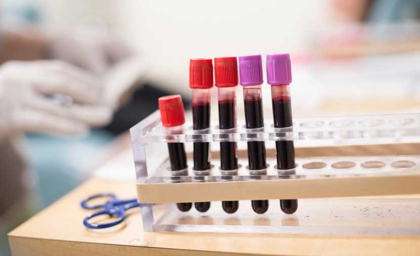 Full blood vials in a rack.