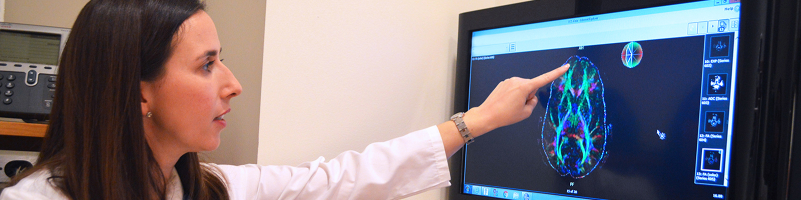 Doctor reviewing a model of a brain on a screen.